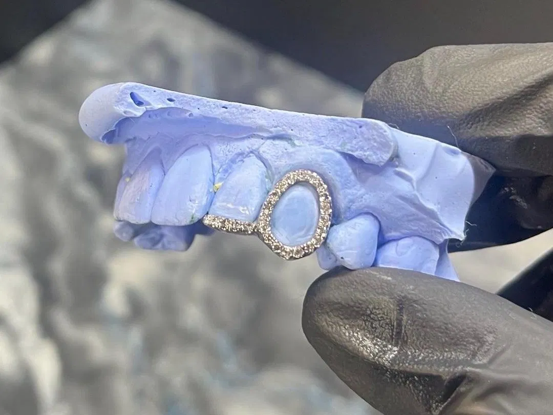Diamond Halo Tooth